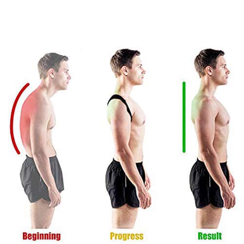 Đai Chống Gù Lưng Nhật Bản Royal Posture Giữ Đúng Tư Thế Chống Cong Vẹo Định Hình Vai Lưng Cổ