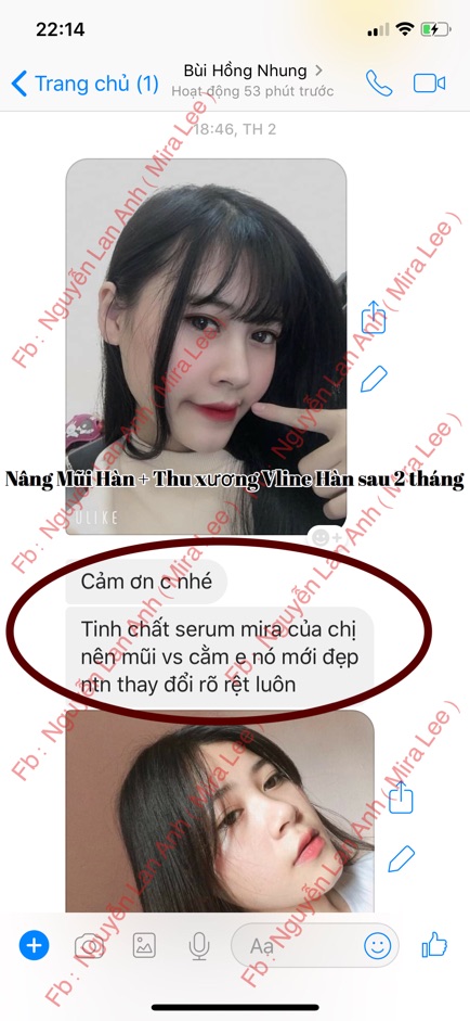 Serum Nâng Cao Mũi Hàn