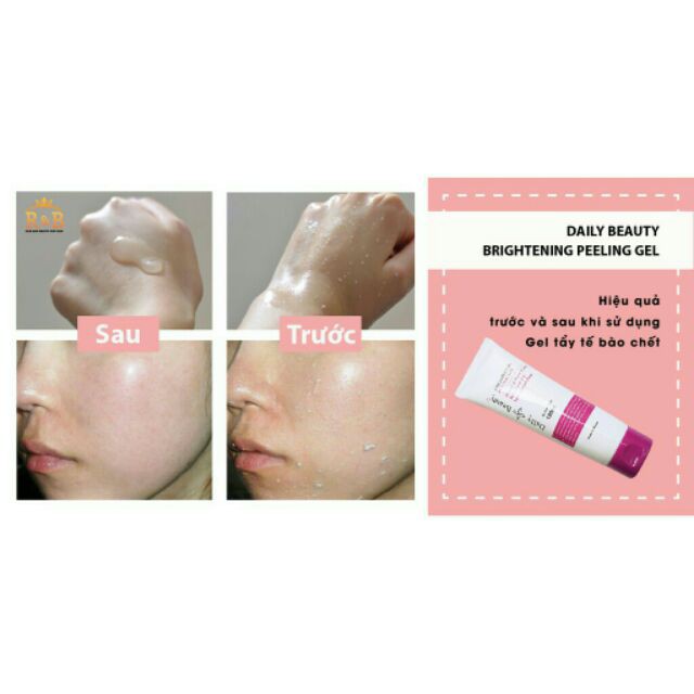 [Hàng Chính Hãng] Gel tẩy tế bào chết- Gel tẩy da chết Daily Beauty, tẩy sạch hiệu quả, an toàn, dịu nhẹ với da | BigBuy360 - bigbuy360.vn