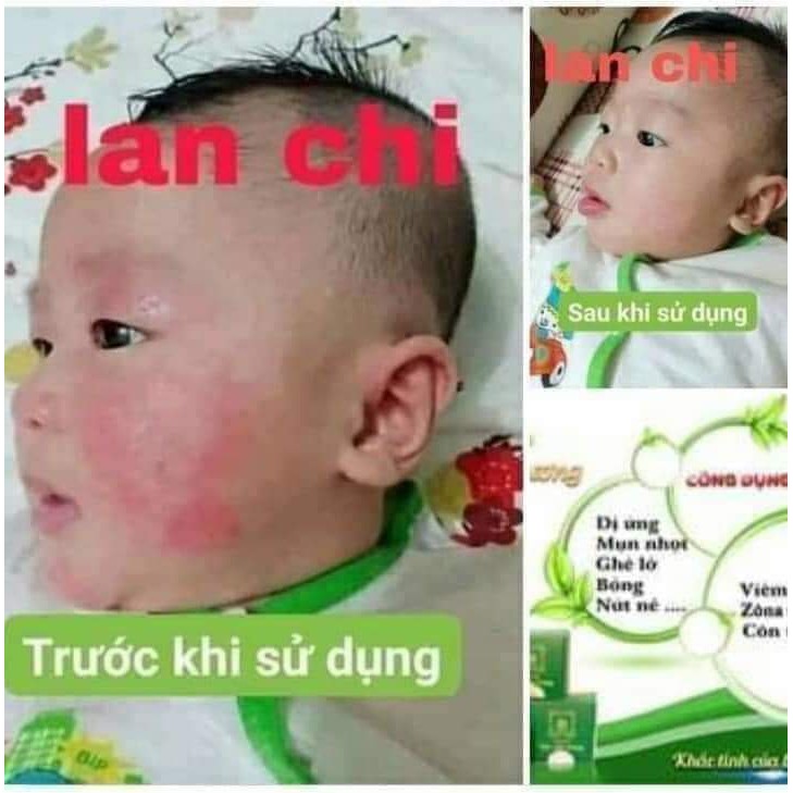 KEM BÔI DA LAN CHI _ MỘC LIỄU VƯƠNG