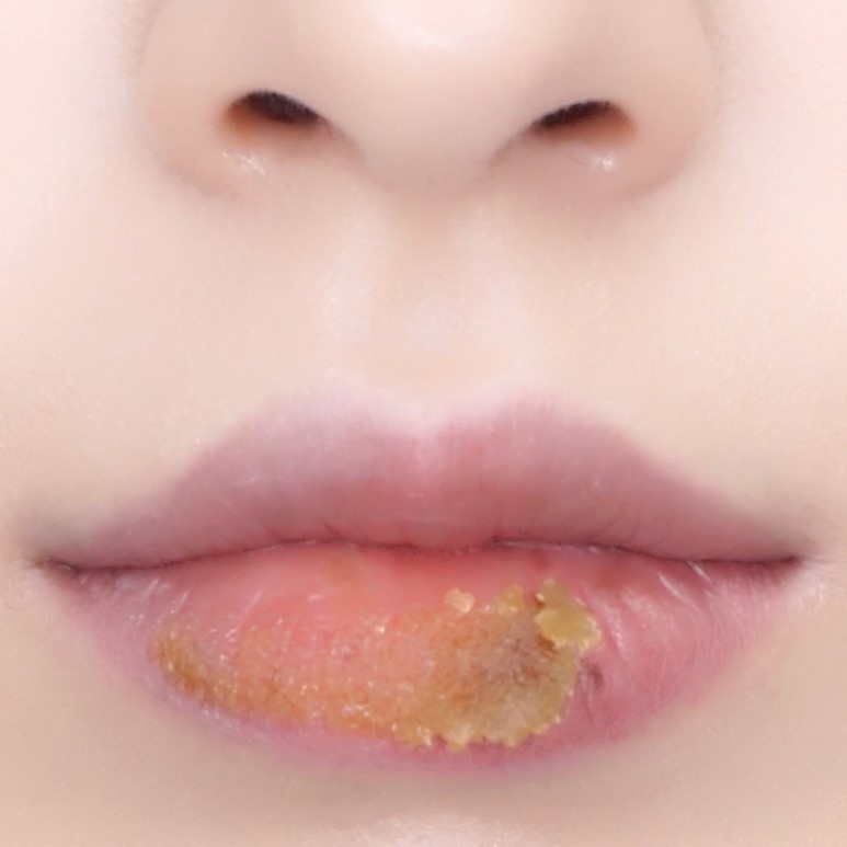 Tẩy da chết môi SKINFOOD Avocado &amp; Sugar Lip Scrub (14g)
