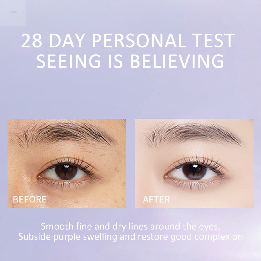 Kem Dưỡng Da Mắt Chứa Retinol Làm Săn Chắc Da Loại Bỏ Quầng Thâm Nếp Nhăn Và Bọng Mắt Chống Lão Hóa Hiệu GLAMN HIH