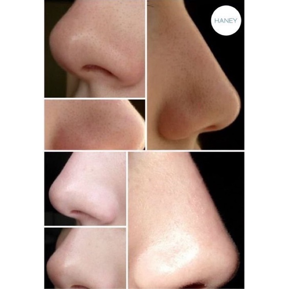 Bộ thải độc sạch sâu căng bóng CO2 Carboxy Sound Ribeskin giúp da trẻ hóa và ngừa mụn