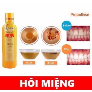 Nước súc miệng Propolinse Nhật Bản