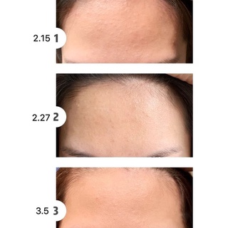 AHA 30% + BHA 2% Peeling Solution the Ordinary - Peeling The ordinary Canada