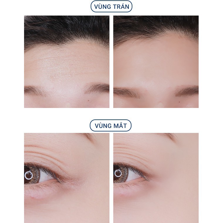 [FREESHIP] Kem nâng cơ săn chắc da MKUP OMG Fine Lines Lifting Treatment Essence 50ml | BigBuy360 - bigbuy360.vn