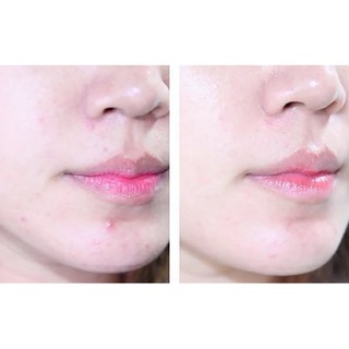 Lotion Diếp Cá Dokudami Nhật Bản 500ml