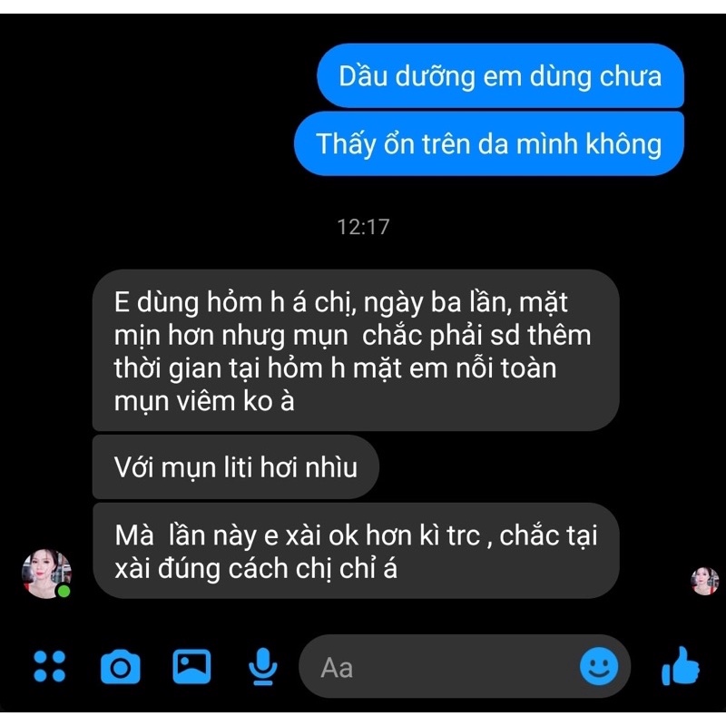 ALBIZIA OIL-Dầu Dưỡng Hoa Chi Bản - Winter Beauty homemade | BigBuy360 - bigbuy360.vn