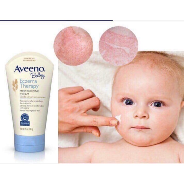 [HÀNG MỸ] KEM DƯỠNG AVEENOBABY aveeno baby ECZEMA 141GRAM CHO BÉ BỊ CHÀM SỮA - Date mới nhất