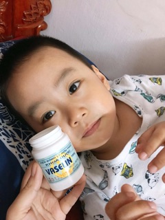 Kem nẻ viện bỏng vaselin