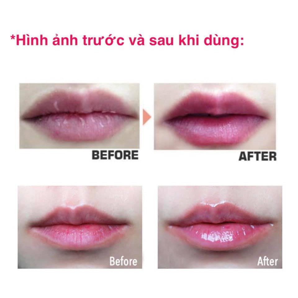 KEM DƯỠNG TRỊ MÔI THÂM CARE NEL LIP