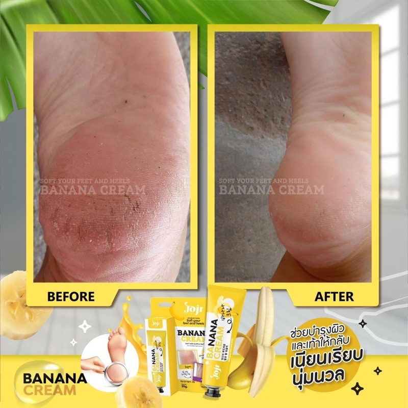 [ HCM SỈ ] Kem giảm nứt gót chân JOJI BANANA CREAM ThaiLand chính hãng