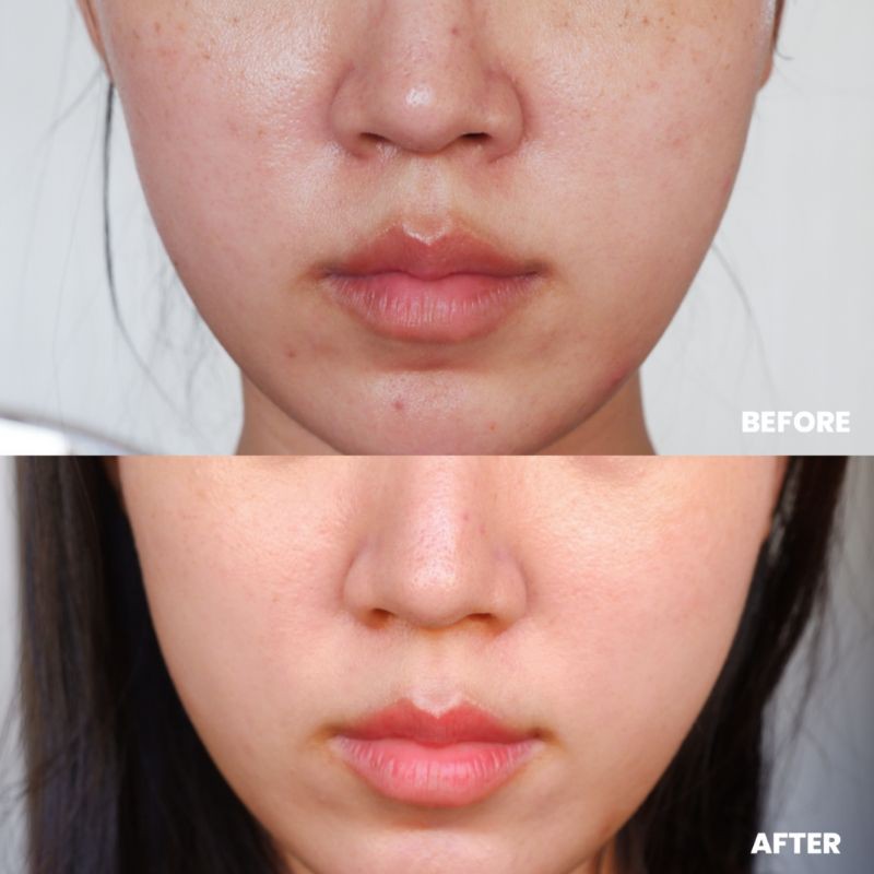[CÓ SẴN] - Krave Beauty_Serum phục hồi Krave Great Barrier Relief | BigBuy360 - bigbuy360.vn