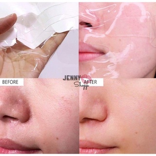 Mặt Nạ Thạch Sinh Học Celderma Hydrogel Mask