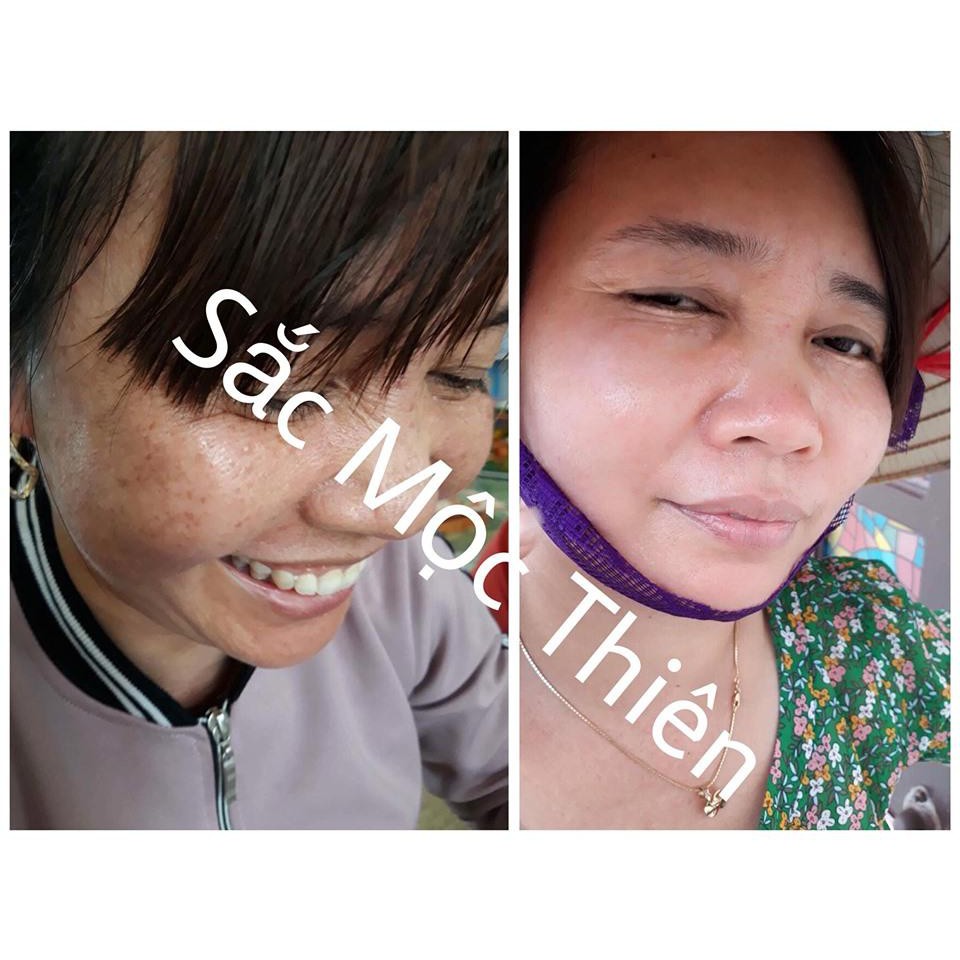 Linh Chi Mộc Sắc Mộc Thiên - Đẩy Nhanh Liệu Trình Tái Tạo Da - Giữ Làn Da Luôn Căng Mịn Và Tươi Trẻ | BigBuy360 - bigbuy360.vn