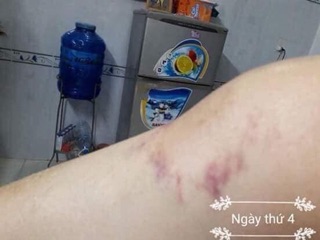 Cao thảo mộc ayofa(cao mát xa đa năng)
