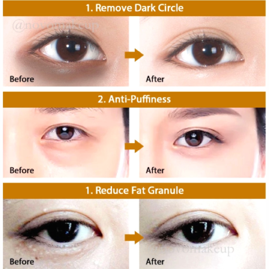 Mặt Nạ Mắt [Hudi] -  Mask Mắt Tinh Chất Collagen Vàng Hàn Quốc