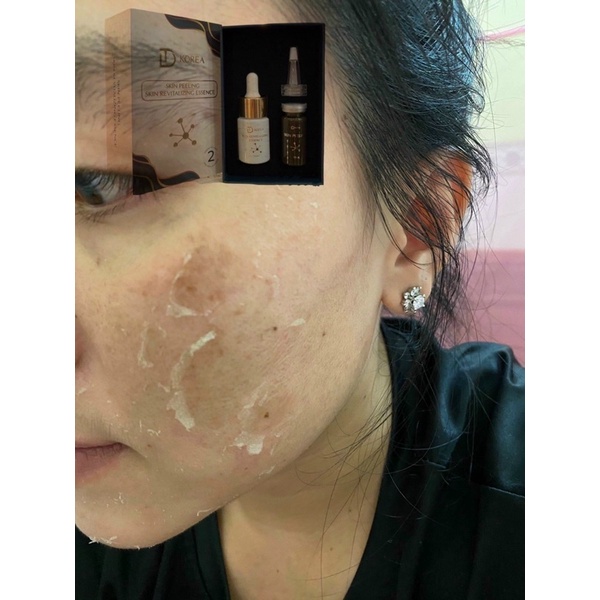 [CHÍNH HÃNG] Tinh Chất Vi Tảo Tái Tạo Da Skin Peeling &amp; Skin Revitalizing Essence Trang Nemo