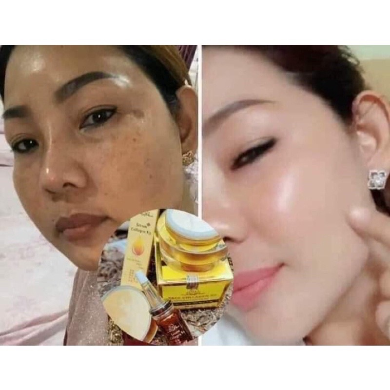Combo Kem Face Collagen X3 Luxury + Serum Colagen X3 công ty Mỹ phẩm Đông Anh Chính Hãng