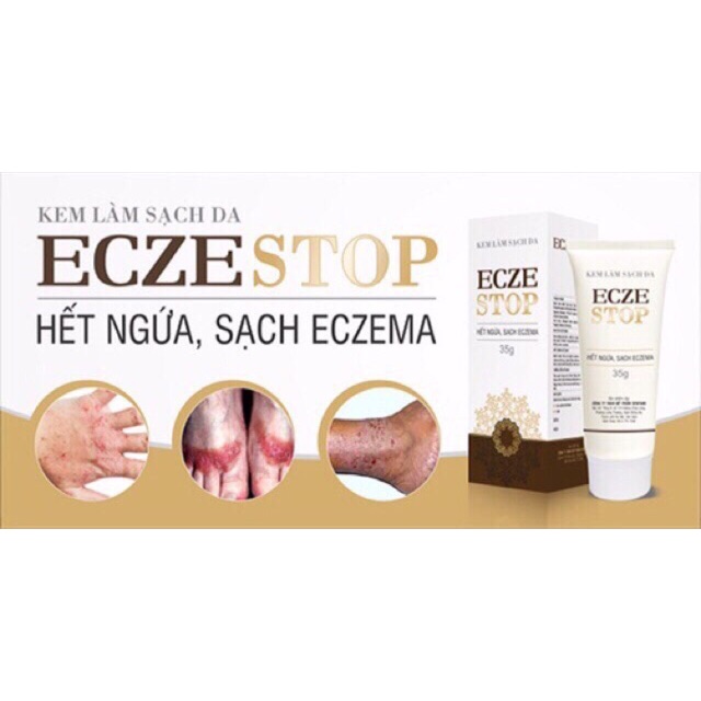 ECZESTOP - KEM BÔI GIÚP HẾT NGỨA, SẠCH ECZEMA