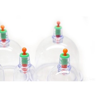 Bộ Giác Hơi Không Dùng Lửa 12 Ly