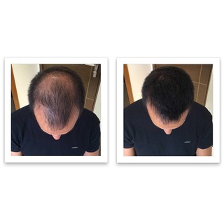 Dầu gội kích thích mọc tóc thảo dược THT