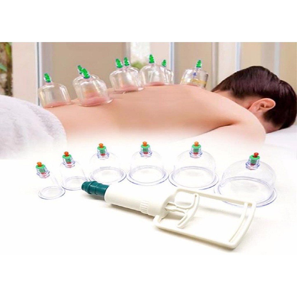 Bộ Giác Hơi Không Cần Lửa 12 Ly Kèm 1 Ống Bơm Chuyên Dụng