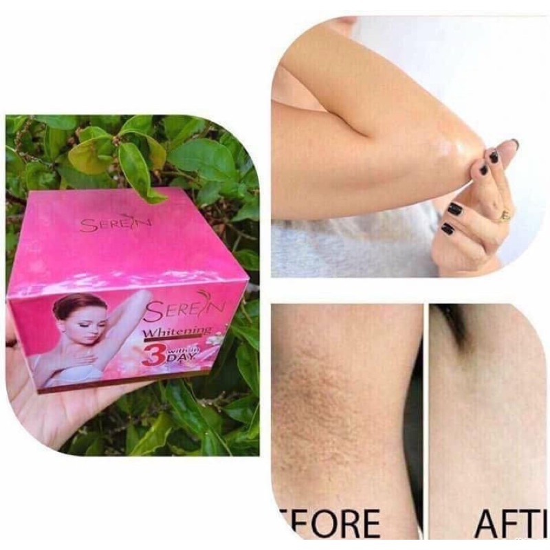 Kem thâm nách Seren 3day Thái Lan [Noon fashion]