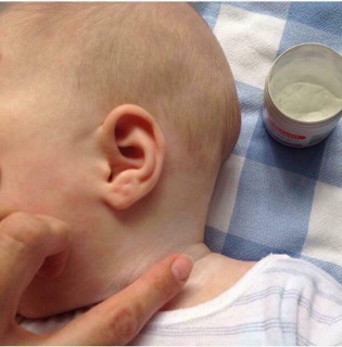 Kem trị hăm tã , trị chàm sudocrem 60gr