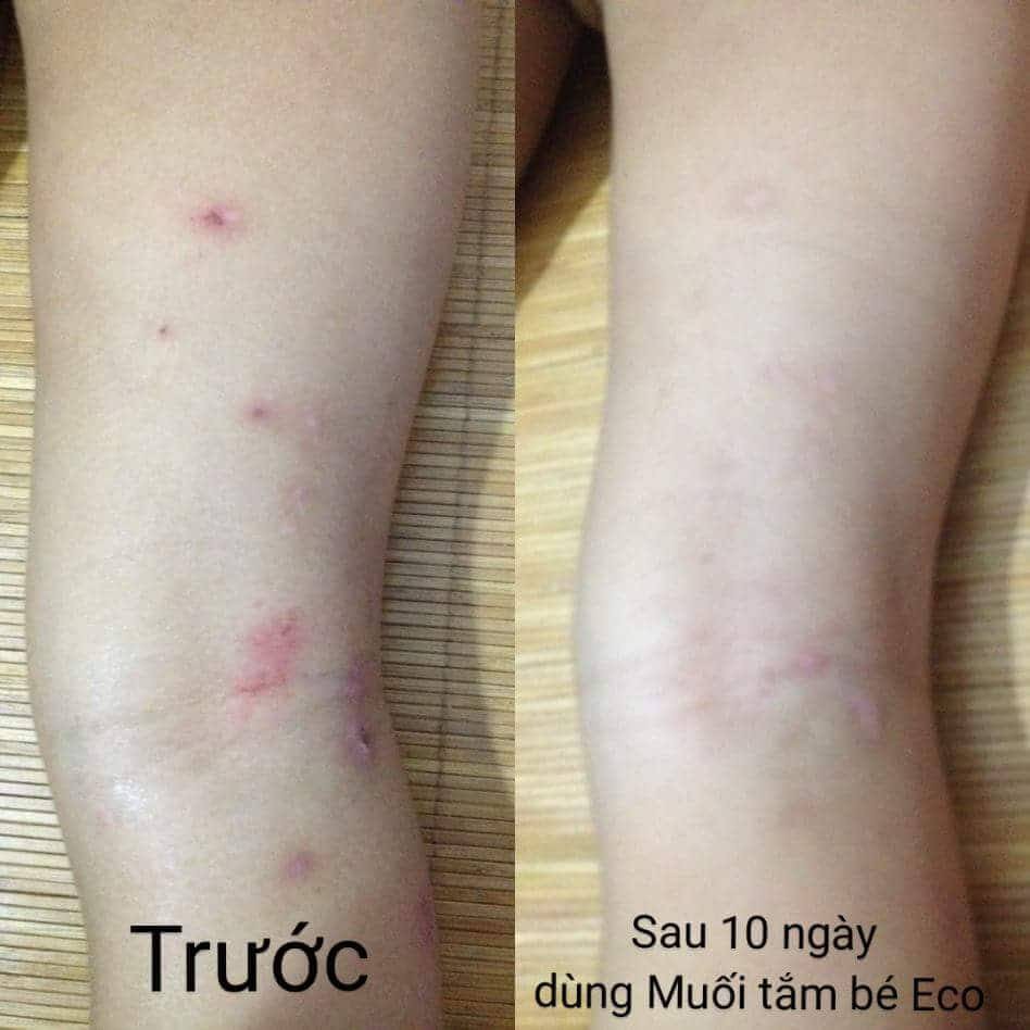 Combo muối tắm bé Eco Sinh Dược 200g và sáp thoa da Eco