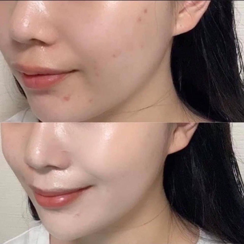 phấn cushion C.lio - ALISA | BigBuy360 - bigbuy360.vn