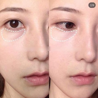 Thanh lăn mắt Simple