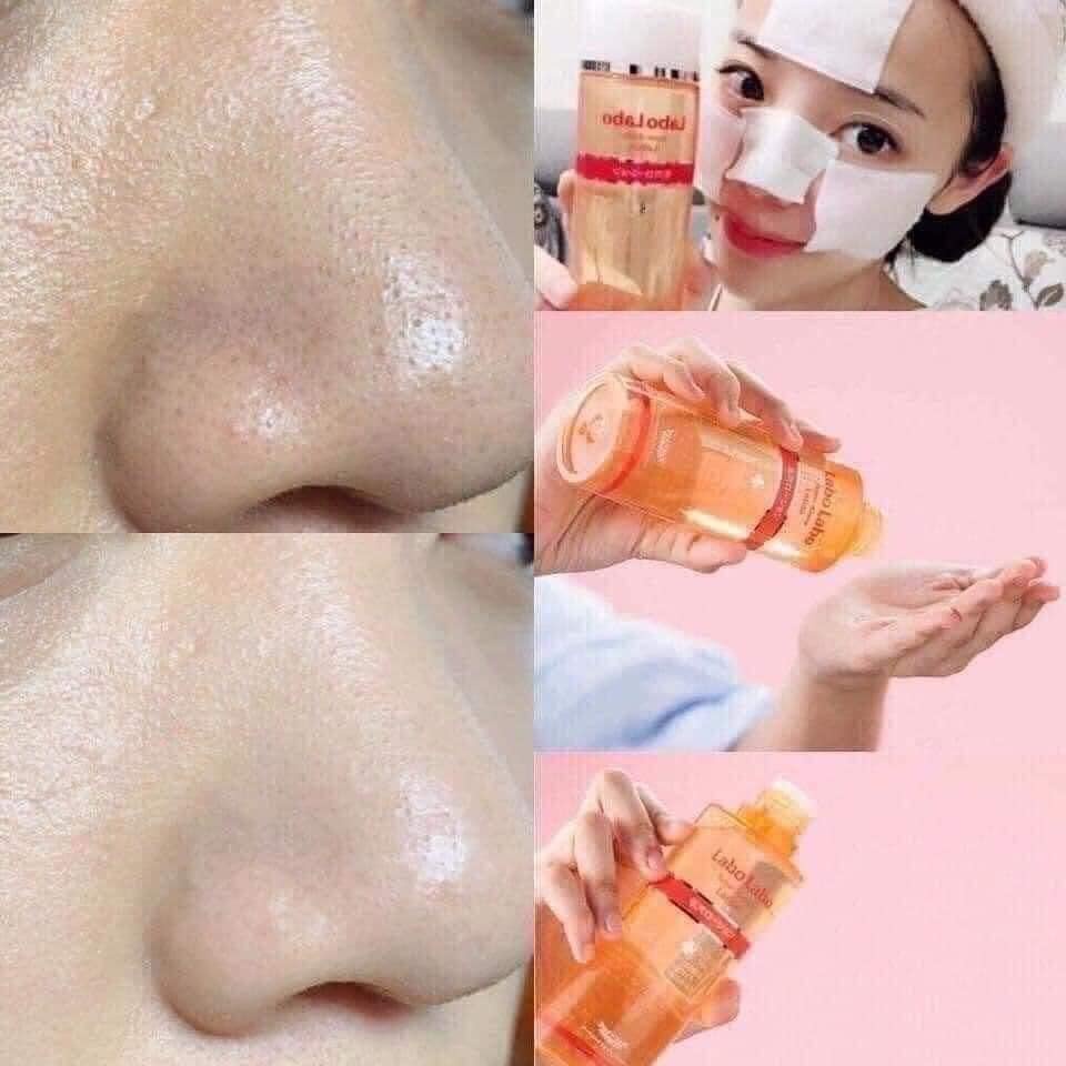 LOTION NƯỚC HOA HỒNG LABOLABO SE KHÍT CHÂN LÔNG - ALISA