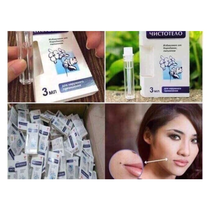 Loại 3ml GEL TẨY NỐT RUỒI, MỤN CƠM, MỤN CÓC, SẸO LỒI, THỊT THỪA - nhập khẩu Nga