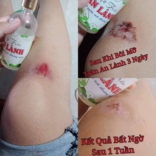 MỠ TRĂN DƯỢC LIỆU AN LÀNH