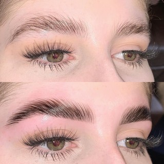 Duỗi Lông Mày, Ép Màng Lông Mày Xu Hướng Mới