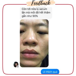 Serum Mờ Thâm Mắt - Môi Handmade