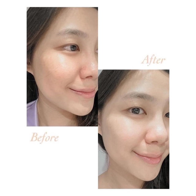 Serum trắng da, mờ thâm nám tàn nhang Neoretin Discrom Control Serum Booster Fluid 15ml