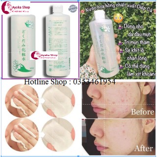 Nước Hoa Hồng lotion toner diếp cá Dokudami Ngăn Ngừa Mụn, Sáng Da 500ml -Mỹ Phẩm Nhật Nôi Đia AyakaShop