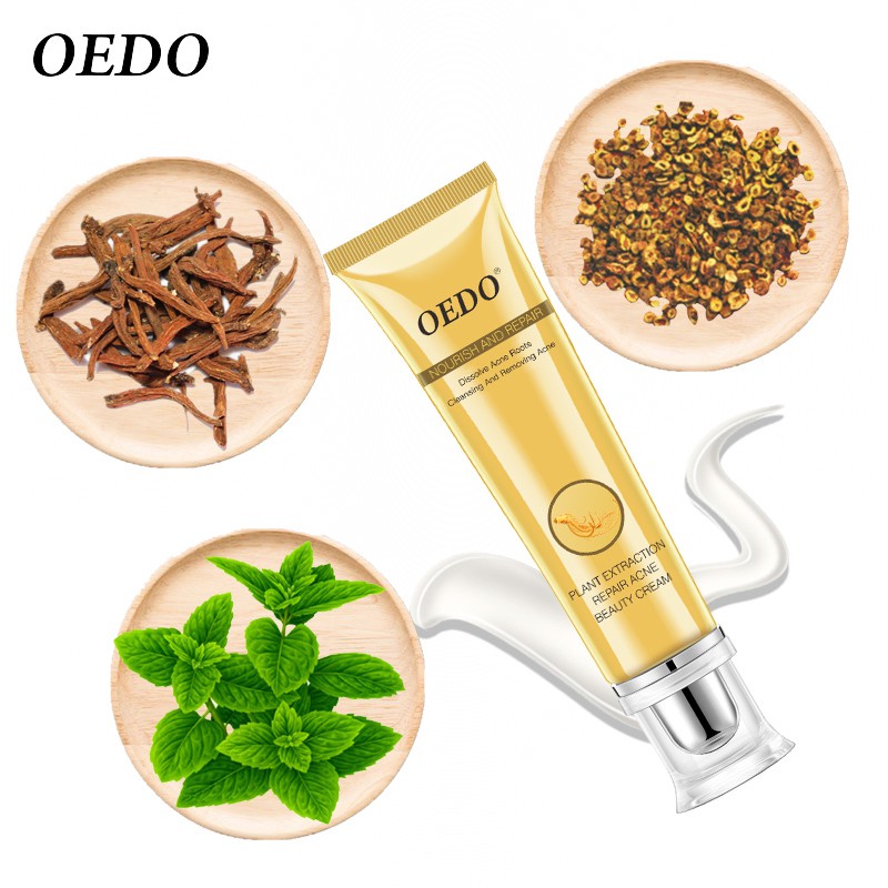 Kem Hỗ Trợ Giảm Mụn OEDO Kiềm Dầu Thu Nhỏ Lỗ Chân Lông Ngăn Ngừa Mụn 20g | BigBuy360 - bigbuy360.vn