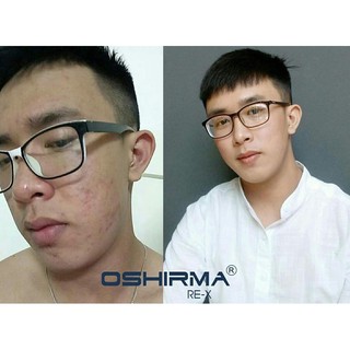 Serum Mụn Thâm Oshirma 10gram