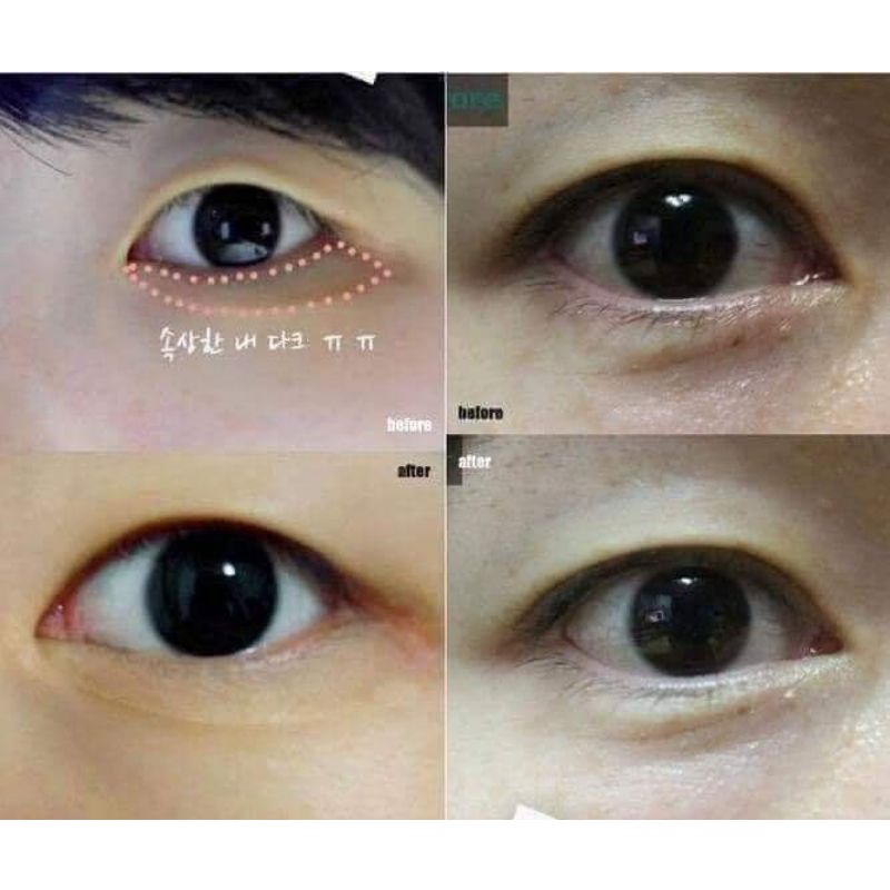 kem mắt tổ yến 25ml | BigBuy360 - bigbuy360.vn