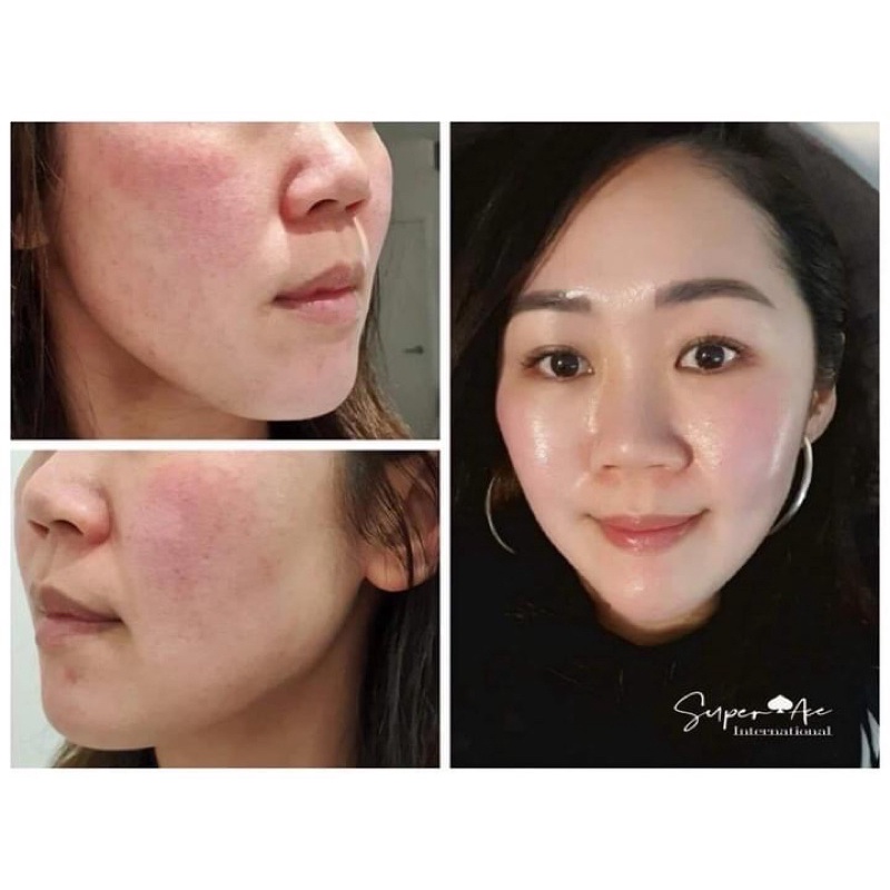 Serum DR’s Secret ngăn ngừa lỗ chân lông to 30ml
