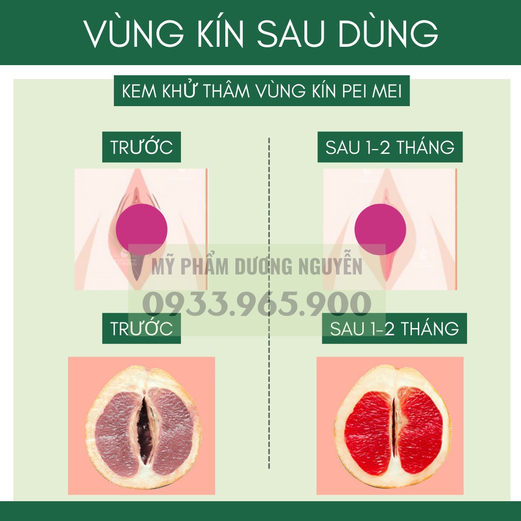 Chống Thâm Môi - Làm Hồng Môi - Nhũ Hoa - Vùng Kín Pei Mei Sexy Pink Bioaqua 30g