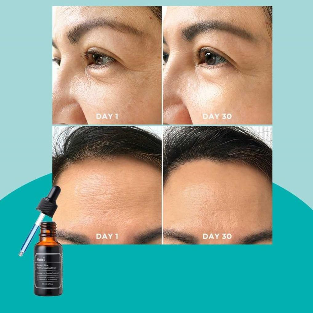 Tinh Chất Dưỡng Phục Hồi, Ngừa Lão Hóa Da Dear, Klairs Midnight Blue Youth Activating Drop 20ml