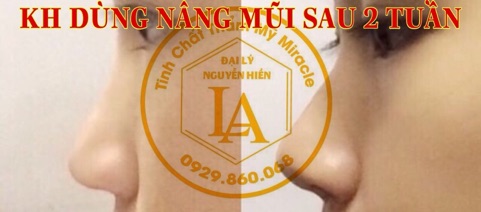 [ HÀNG CAO CẤP ] Tinh chất nâng mũi Pháp Miracle