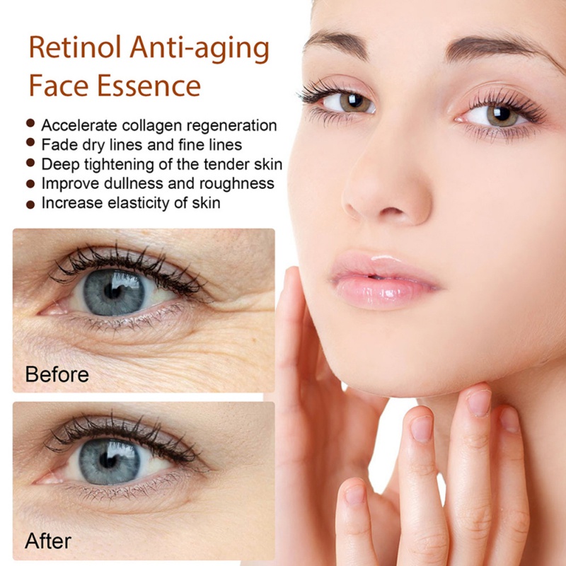Tinh Chất Retinol Chống Lão Hóa Xóa Nếp Nhăn Dưỡng Ẩm Làm Săn Chắc Và Sáng Da