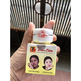 KEM TRẮNG DA MỤN BẢO LÂM 10G
