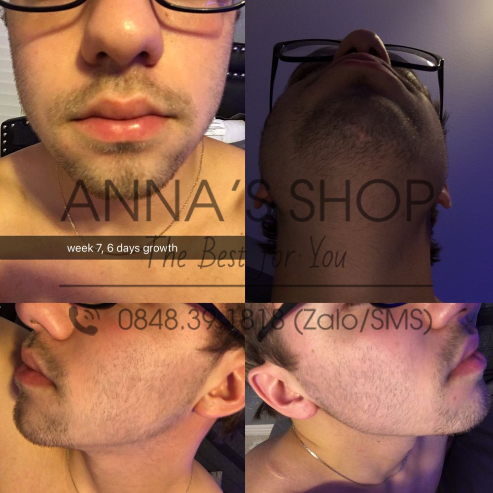 Viên Uống Cung Cấp Dinh Dưỡng Cho Râu Iron Beard Vitamin 60 Viên