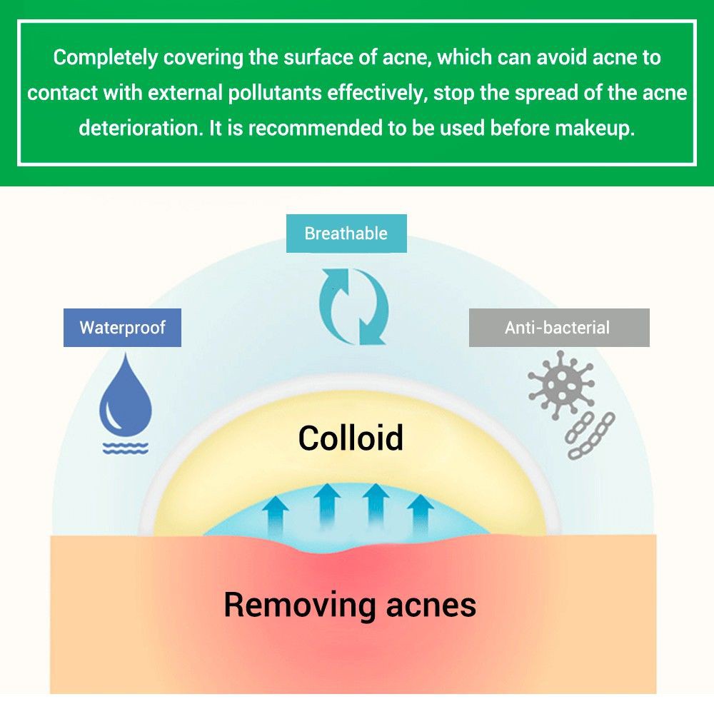 (Hàng Mới Về) Miếng Dán Trị Mụn Trứng Cá Ban Đêm Tiện Dụng | BigBuy360 - bigbuy360.vn